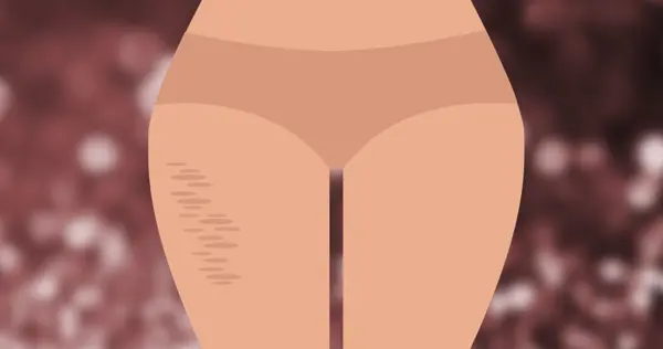 Legs